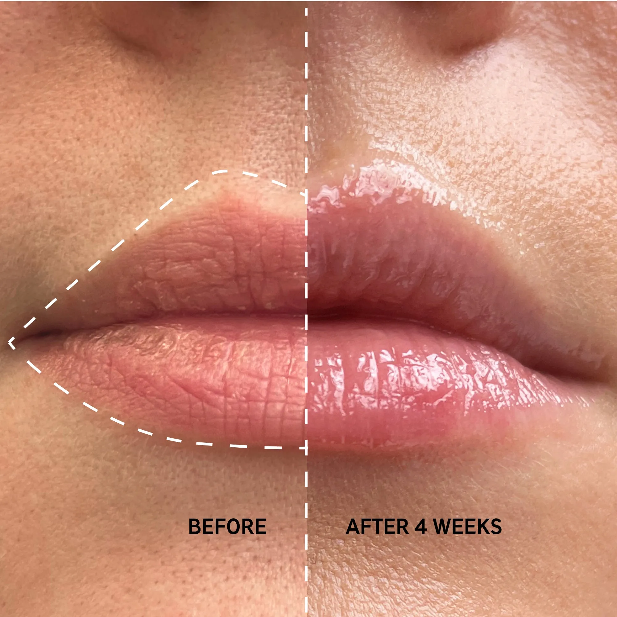 Complete Lip Set