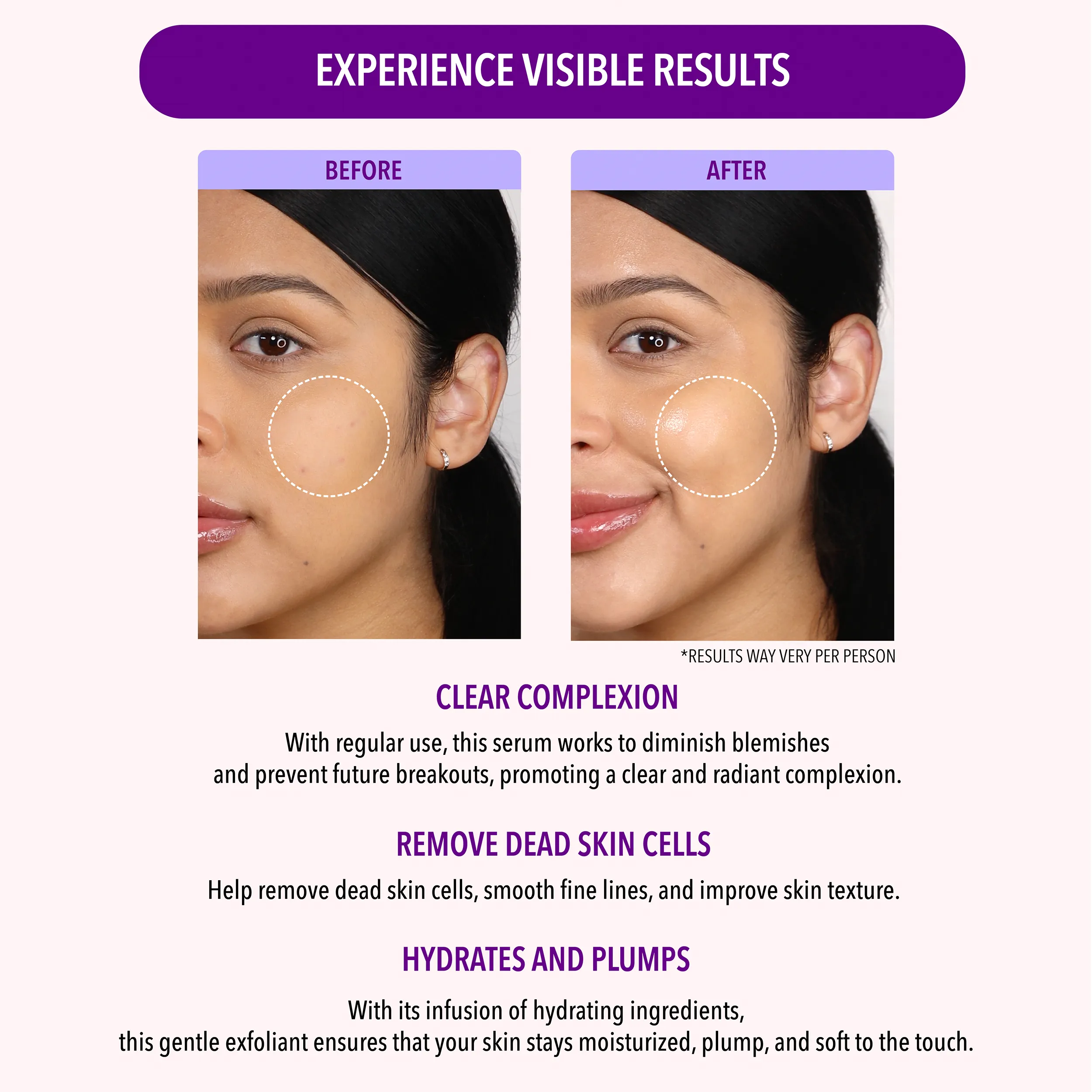 Oil Control Skincare Collection