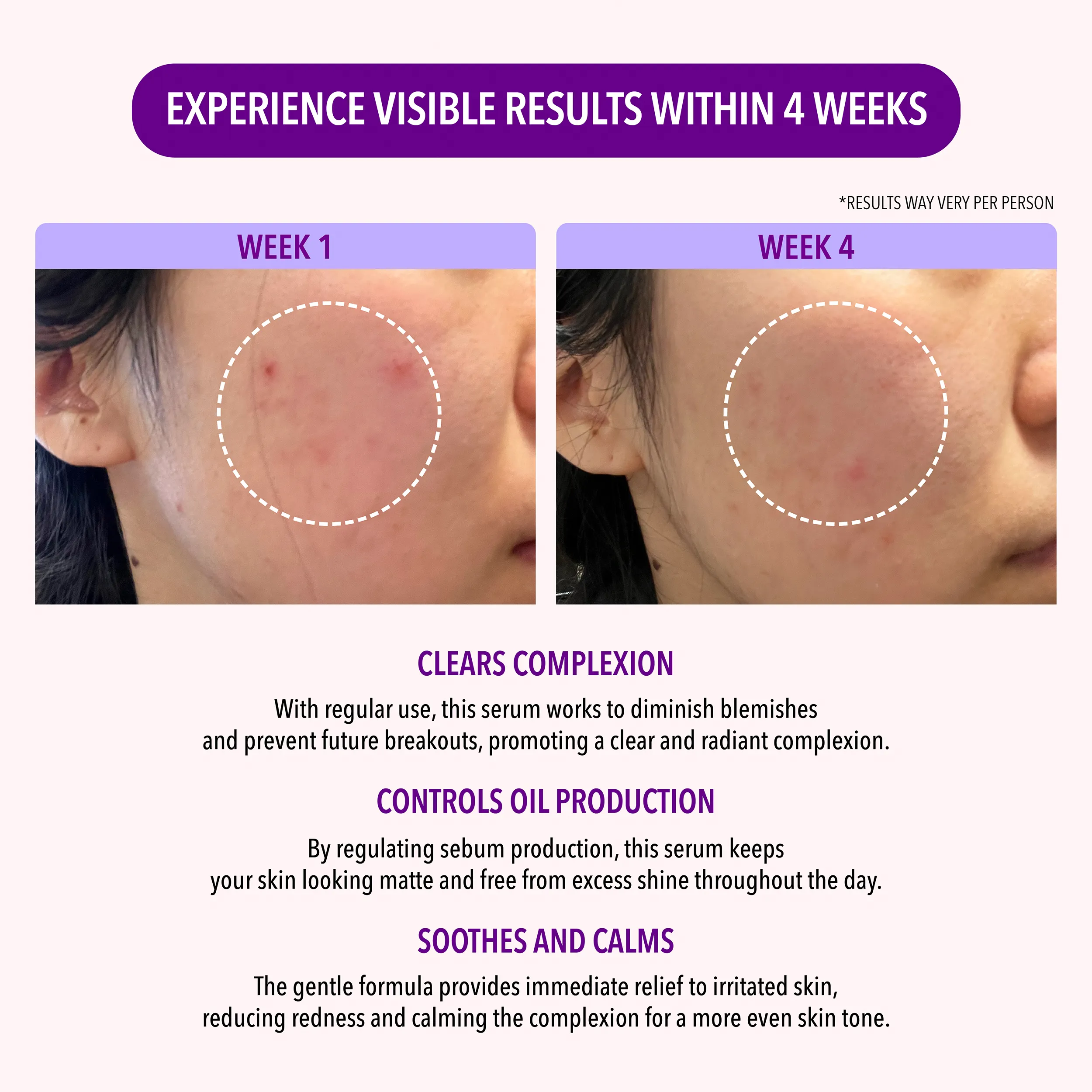 Oil Control Skincare Collection